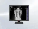 4MP Medical Display