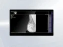 8MP Portable Diagnostic Display
