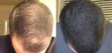 Look, you are most likely reading this because you are freaking out about losing hair. Stop...