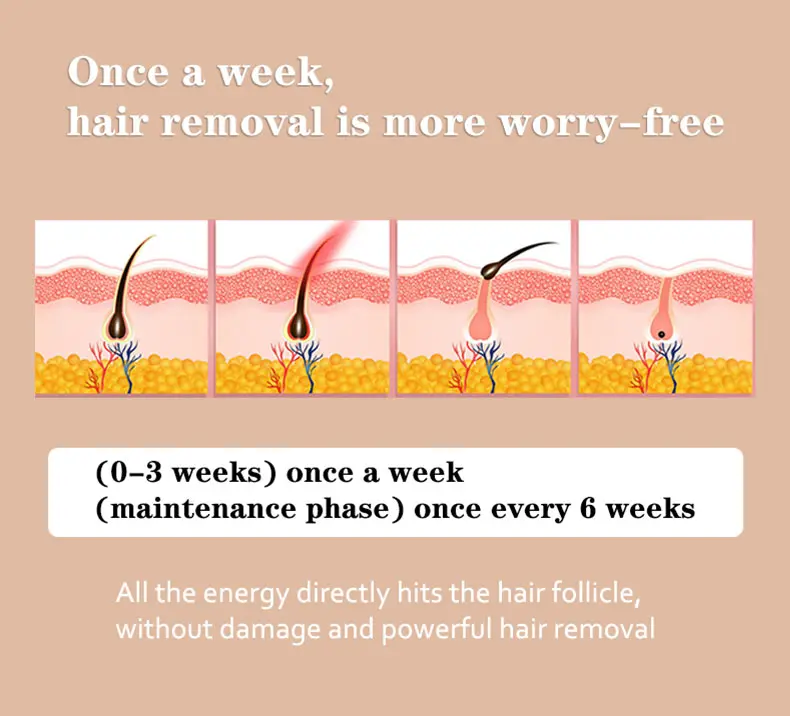 hair removal system