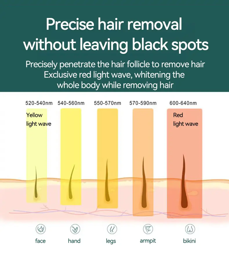  Laser hair removal